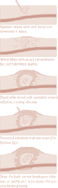 Potential Health Complications of Injection Drug Use - National Harm ...