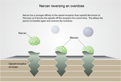 illustration of how Narcan reverses an overdose by bumping out and replacing opioids in the brain's opioid receptors