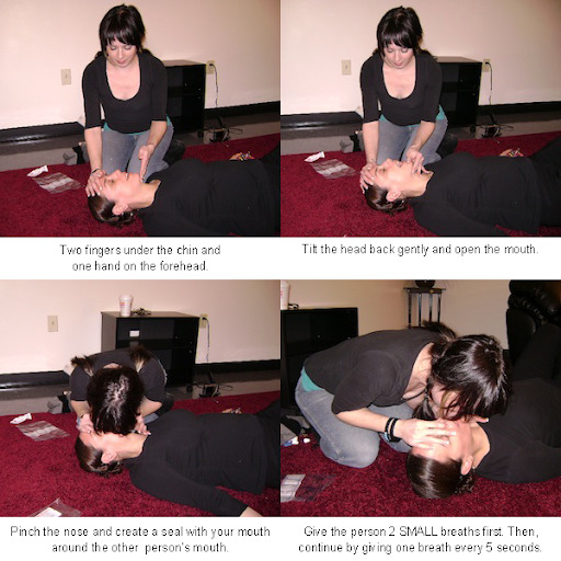 four images showing the proper way to administer rescue breaths in case of an overdose.